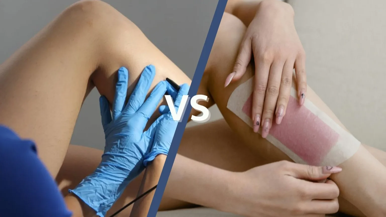 Electrolysis vs Waxing