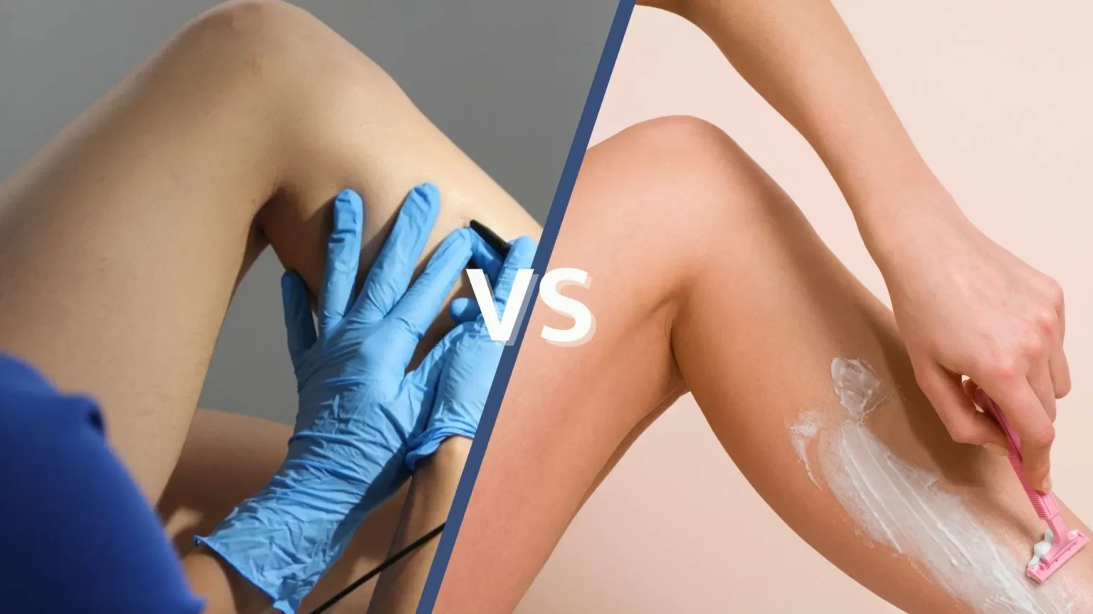 Electrolysis vs Shaving