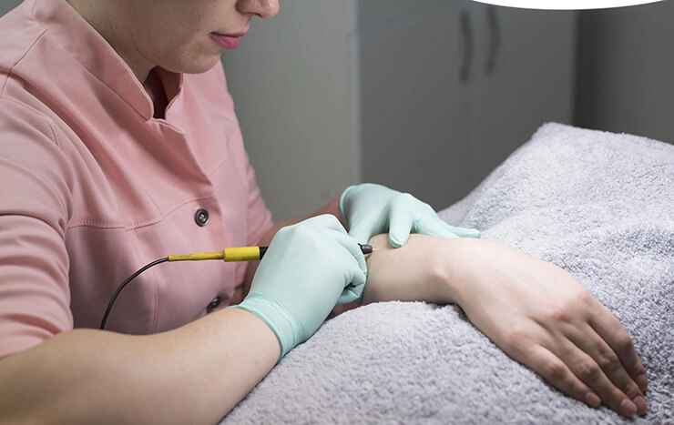 Compare Electrolysis vs. Laser Hair Removal