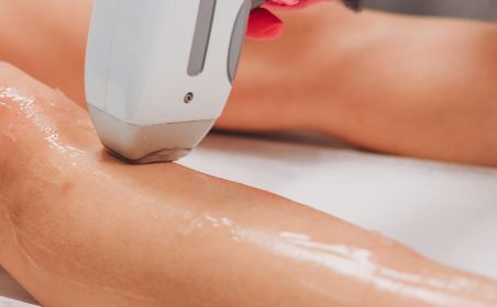 Laser vs electrolysis permanent hair removal