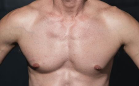 Chest hair removal