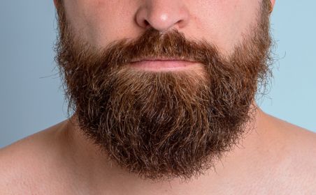 permanent hair removal for beard