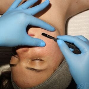 Dermaplaning facial