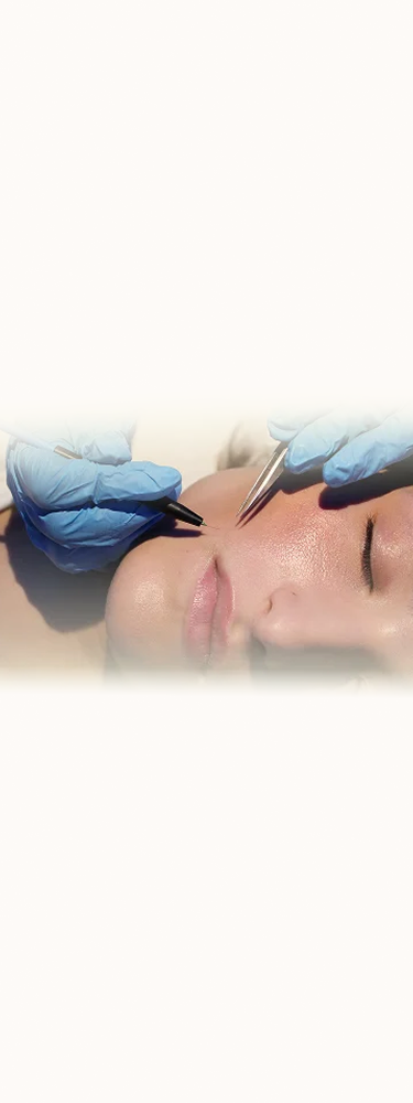 Electrolysis Permanent Hair Removal in NYC