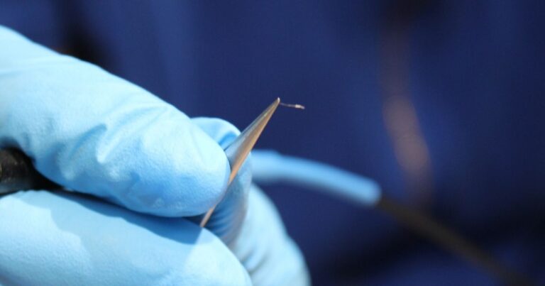 Diagram showing how electrolysis probe permanently destroys hair follicle growth center