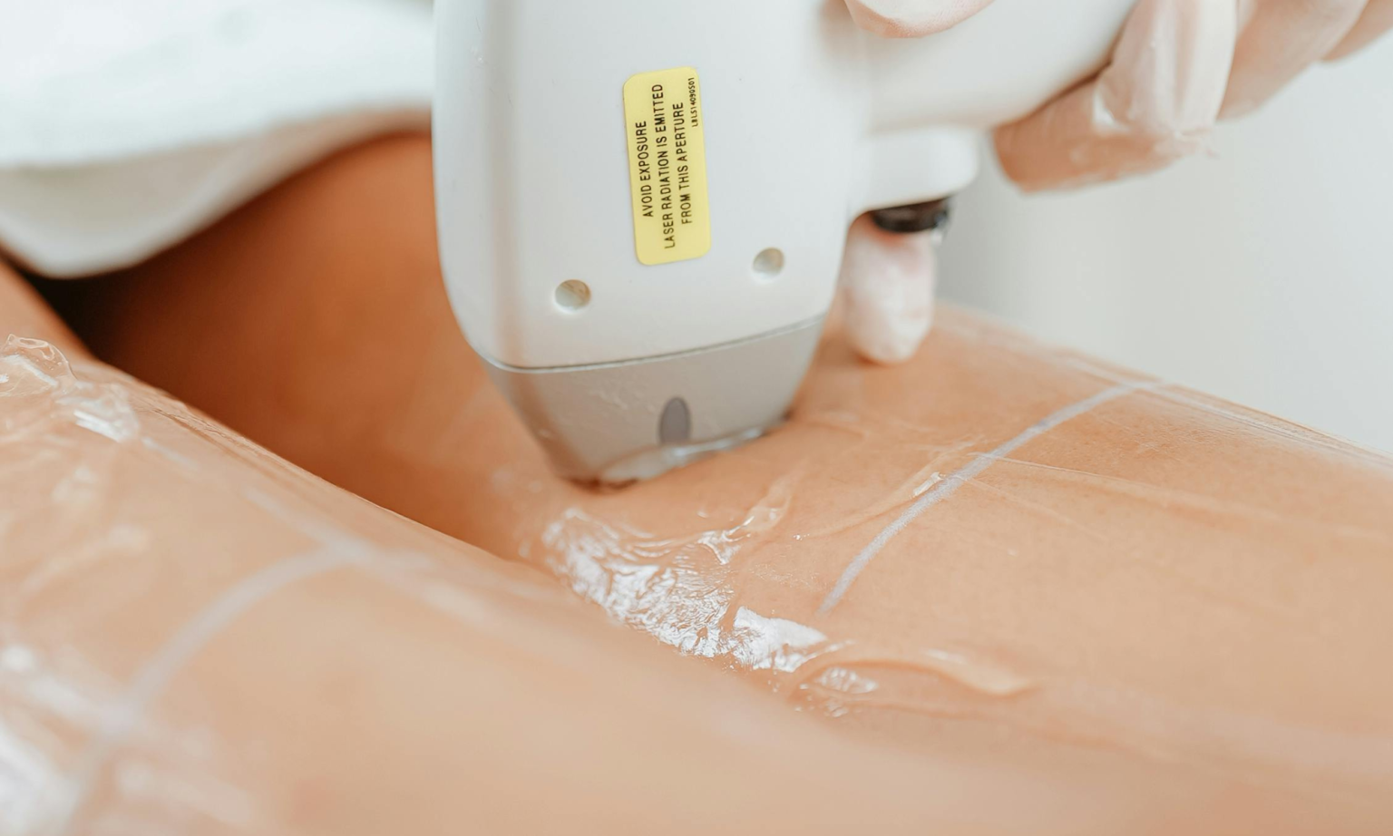 why you can still have hair after laser hair removal