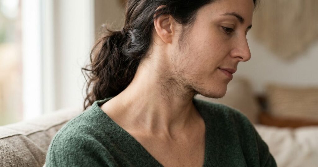thyroid facial hair women neck chin