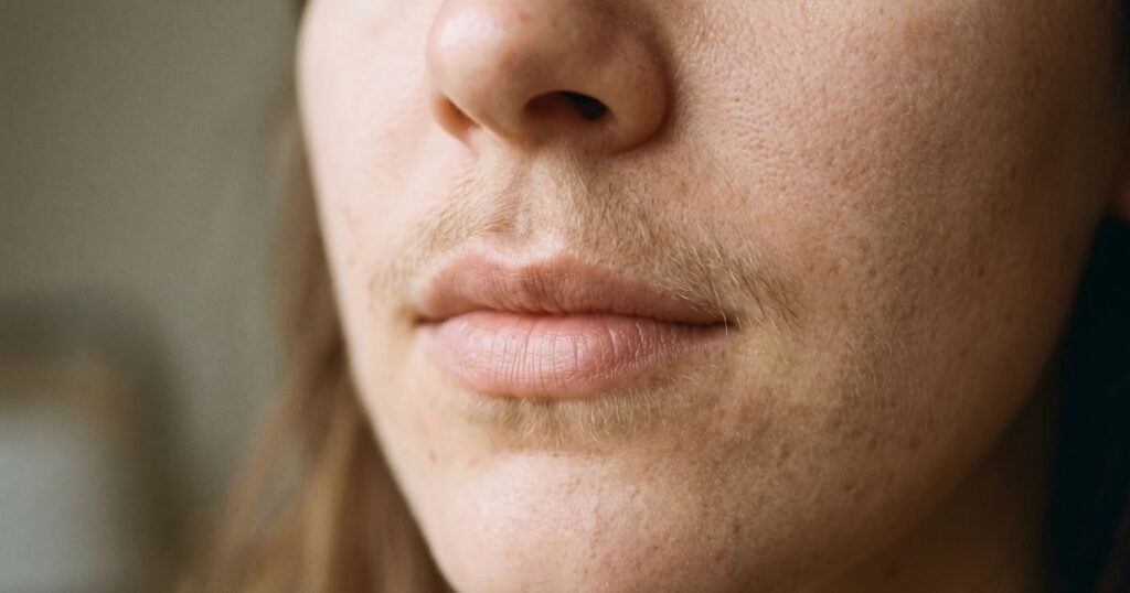 upper lip hair