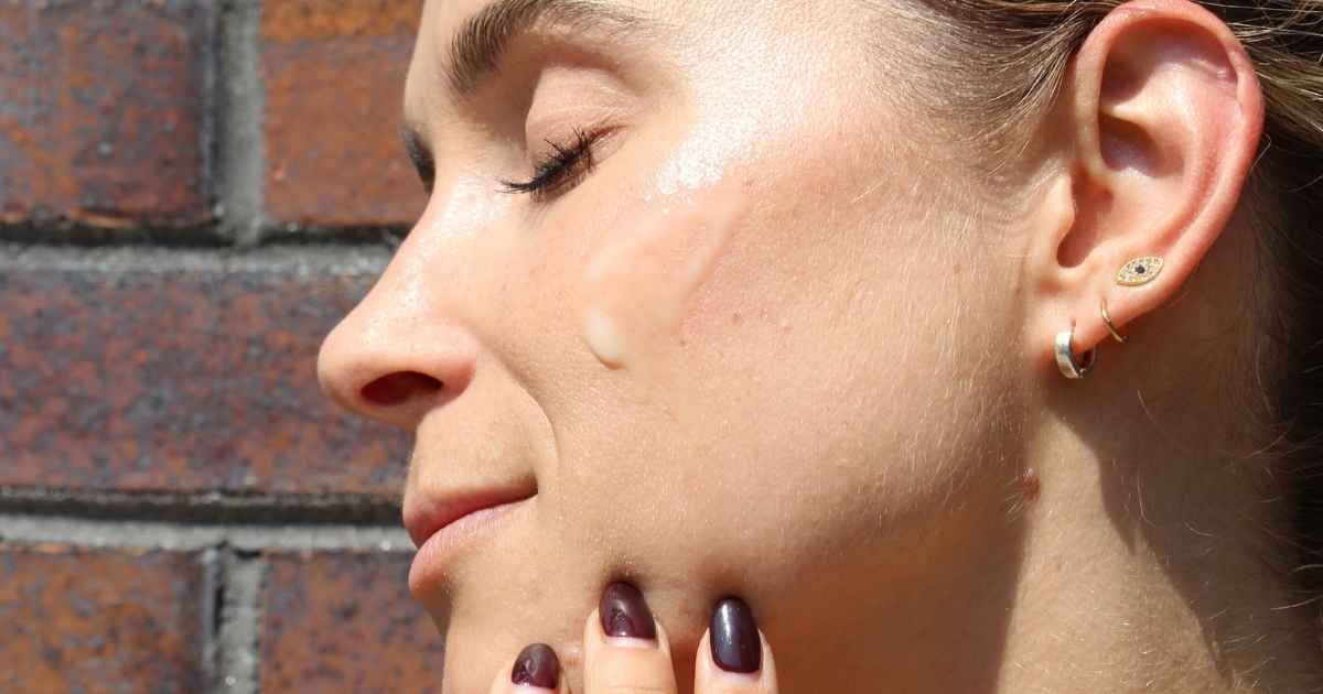chemical peel nios skin lab