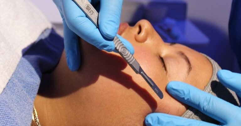 Esthetician in blue gloves running a dermaplaning blade along a client's cheek at Nios Skin Lab